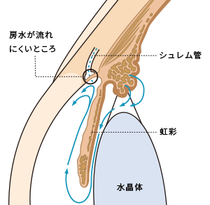 手術前